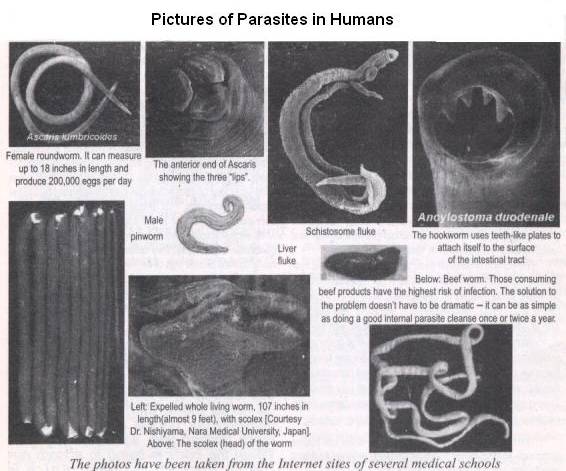 Worms kinds in humans
